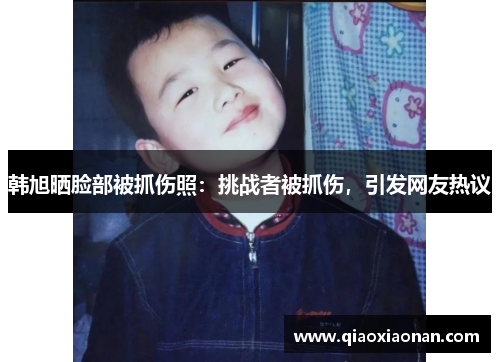 韩旭晒脸部被抓伤照：挑战者被抓伤，引发网友热议